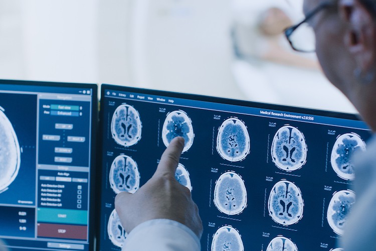 Brain Scans